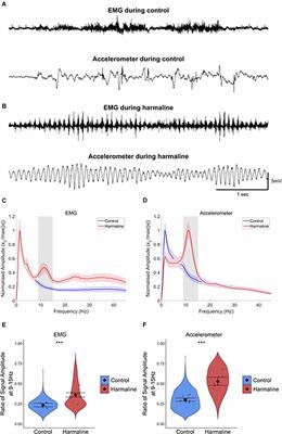 Cerebello-Thalamo-Cortical Network Dynamics in the Harmaline Rodent Model of Essential Tremor